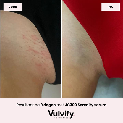 Serenity™ | JG300 Yoni Serum